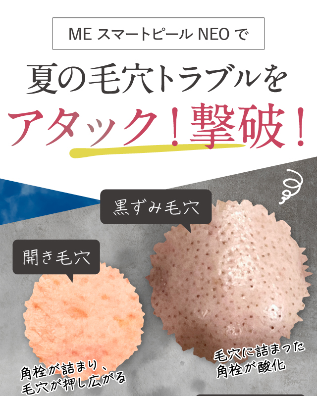 夏の毛穴トラブルにアタック!黒ずみ、開き毛穴を撃破!